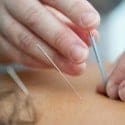 Add Some Needle To Your Digital Sleeve With Acupuncture SEO Services