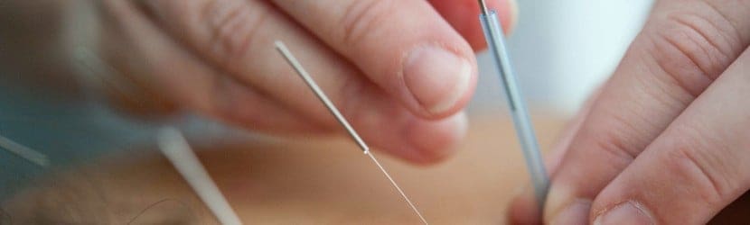 Add Some Needle To Your Digital Sleeve With Acupuncture SEO Services