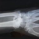 The Ultimate Guide to Personal Injury Law!