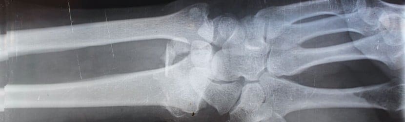 The Ultimate Guide to Personal Injury Law!