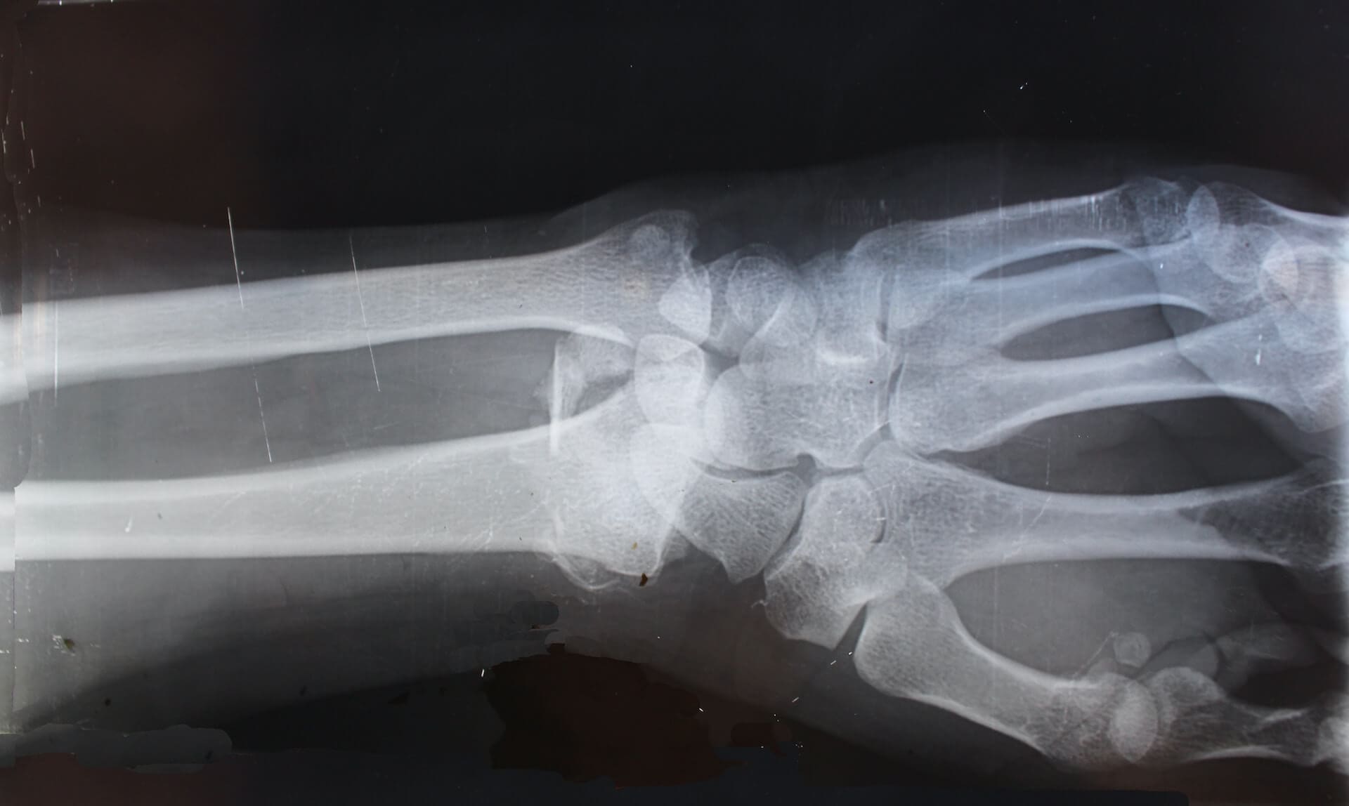 The Ultimate Guide to Personal Injury Law!