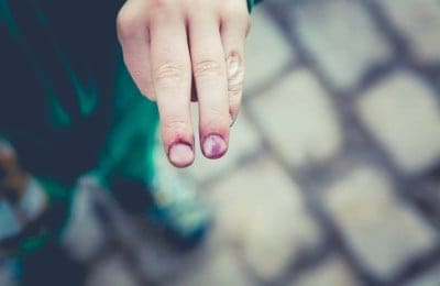 Master the Art of Lead Generation Today!