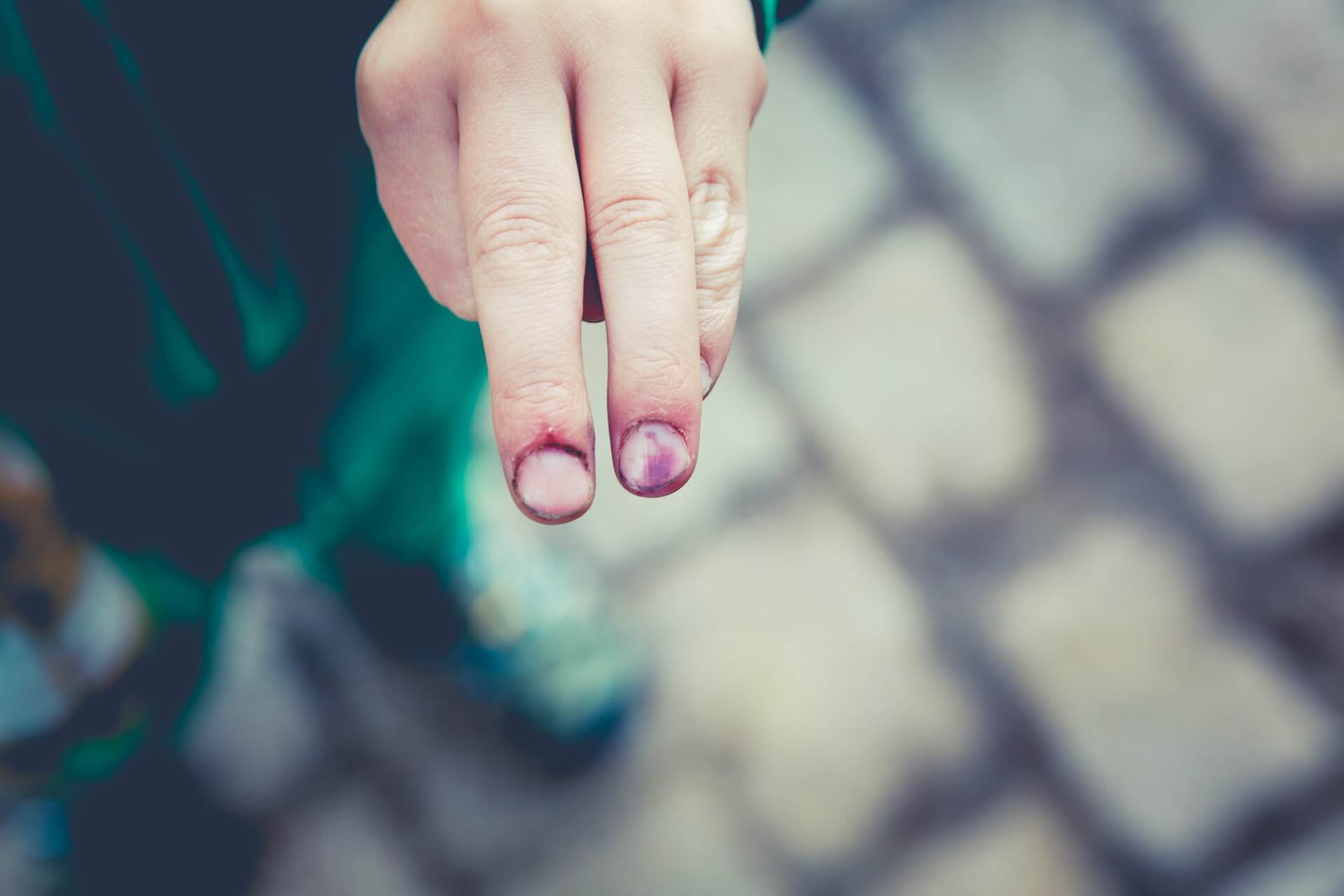 Master the Art of Lead Generation Today!