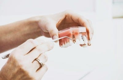 Targeting the Right Audience for Your Denture Services