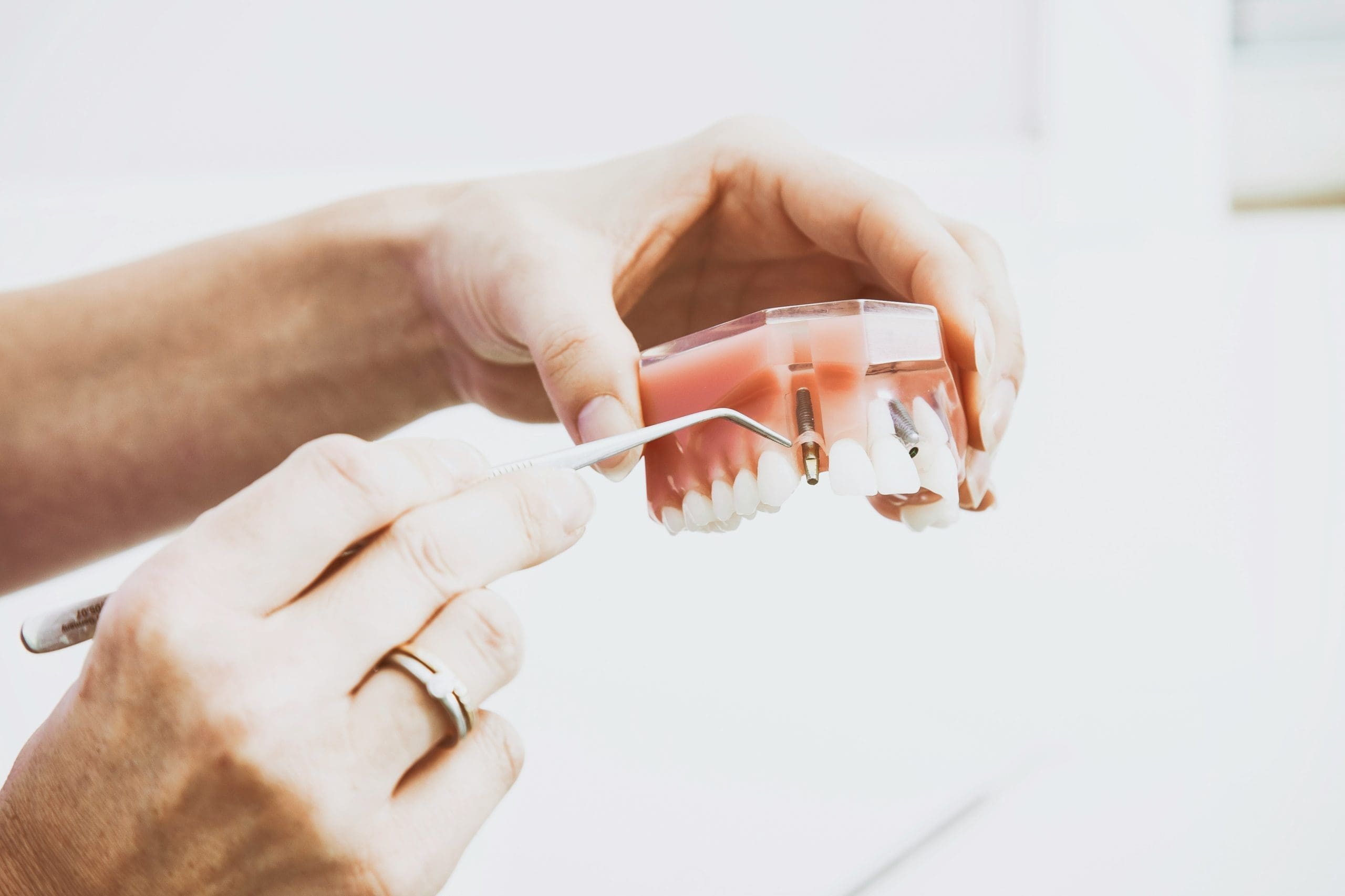 Targeting the Right Audience for Your Denture Services