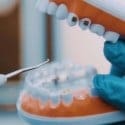 Innovative Dental Promotion Strategies That Attract New Patients
