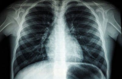 Simplify Personal Injury Cases with Top Case Management Software!