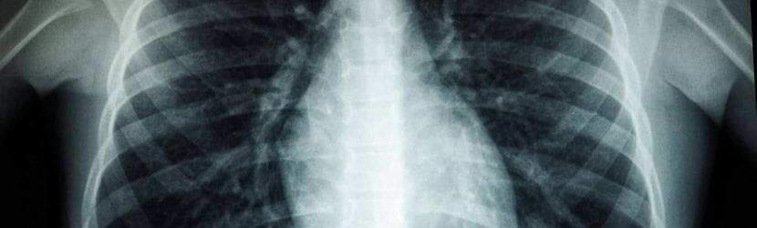 Simplify Personal Injury Cases with Top Case Management Software!